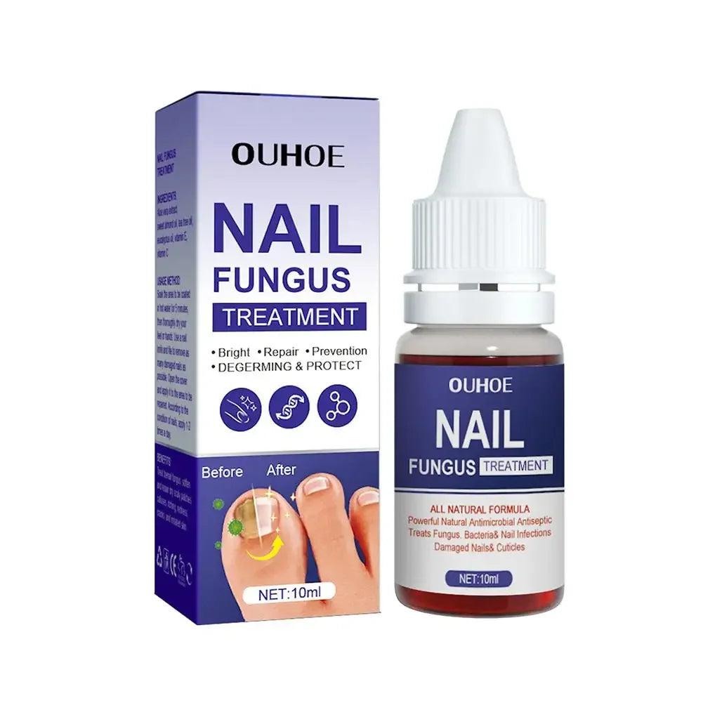 1PCS Nail Fungal Treatment Feet Care Essence Anti Infection Fungal Repair Onychomycosis Nail Fungus Serum Paronychia Remova B9J4